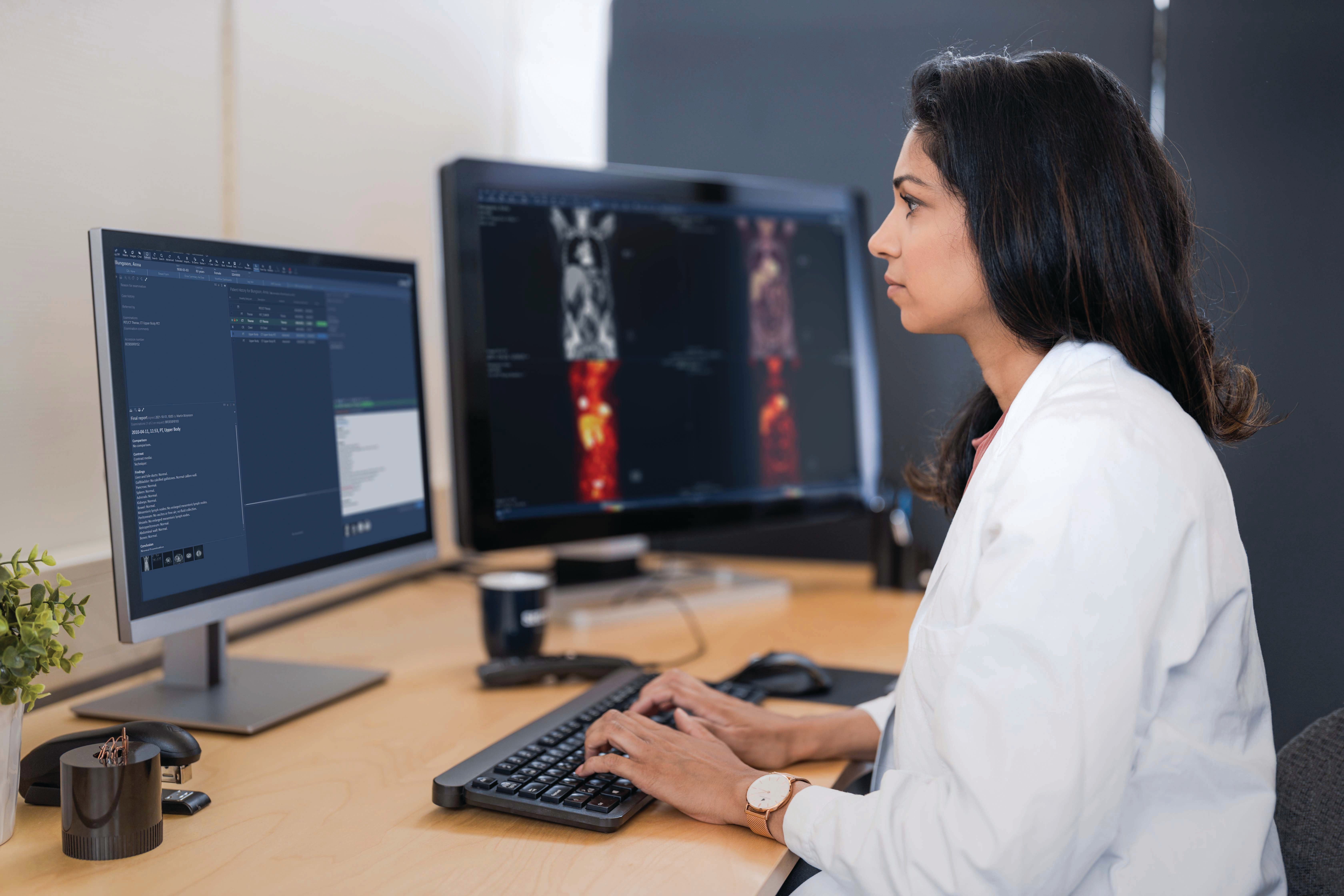 Peter Hedlund: Mycket att gilla med Sectra – men jag lutar mer åt sälj