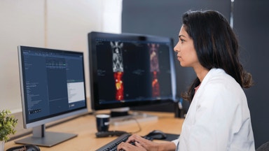 Peter Hedlund: Mycket att gilla med Sectra – men jag lutar mer åt sälj