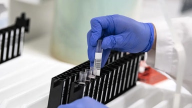 Det ska revolutionera upptäckten av: ”Fantastisk innovation”