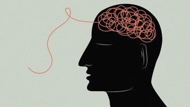 Kan AI lösa gåtan med alzheimer?